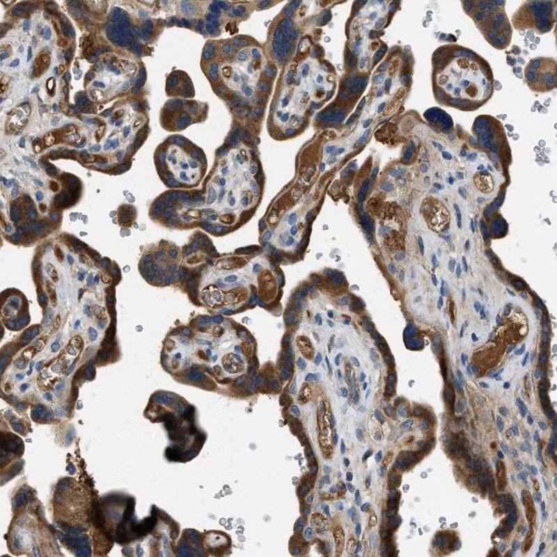 Staining of human placenta shows strong cytoplasmic positivity in Trophoblasts.