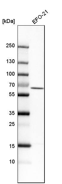 Analysis in human cell line EFO-21.