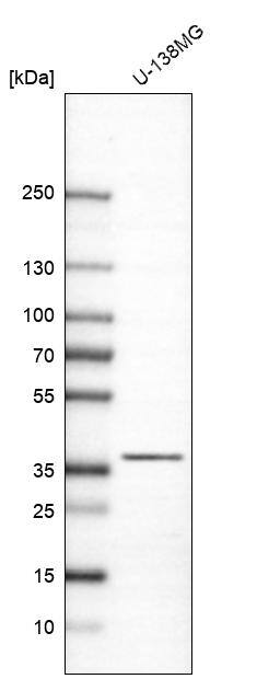 Analysis in human cell line U-138MG.