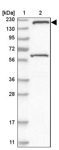 Lane 1: Marker [kDa] 230, 130, 95, 72, 56, 36, 28, 17, 11Lane 2: Human cell line RT-4