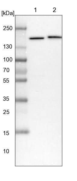 Lane 1: NIH-3T3 cell lysate (Mouse embryonic fibroblast cells)Lane 2: NBT-II cell lysate (Rat Wistar bladder tumour cells)