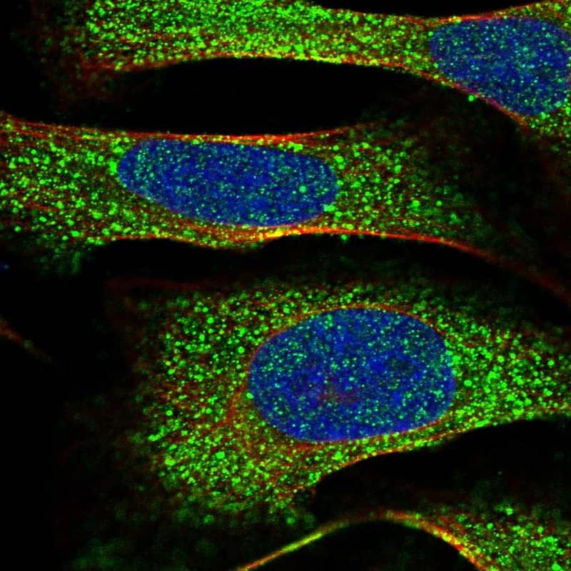 Staining of human cell line U-2 OS shows localization to cytosol.
