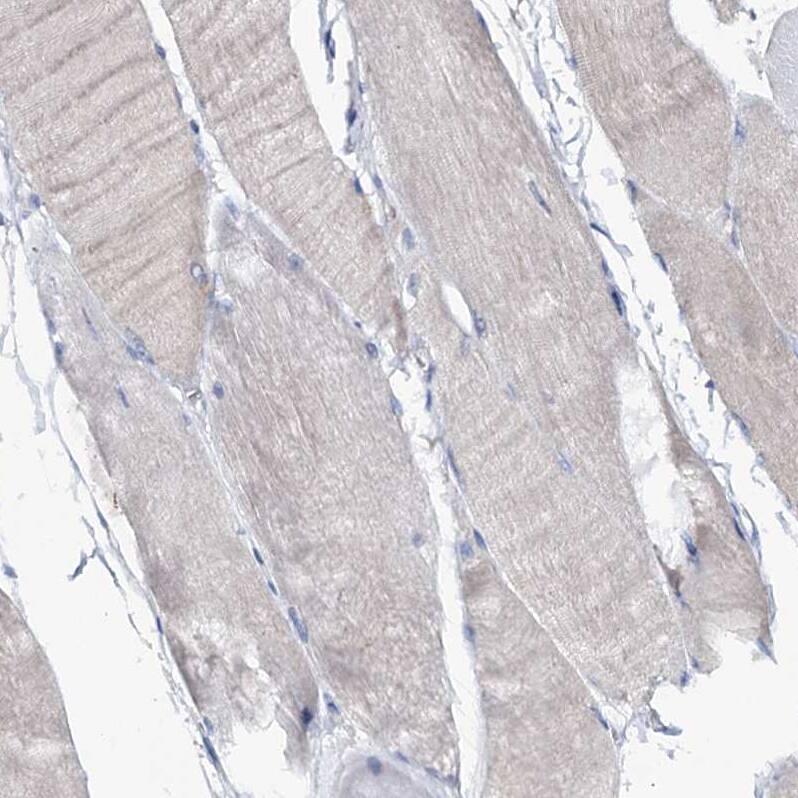 Staining of human skeletal muscle shows no nuclear positivity in myocytes as expected.