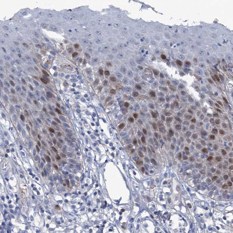 Staining of human skin shows weak to moderate nuclear positivity in the epithelial cells.