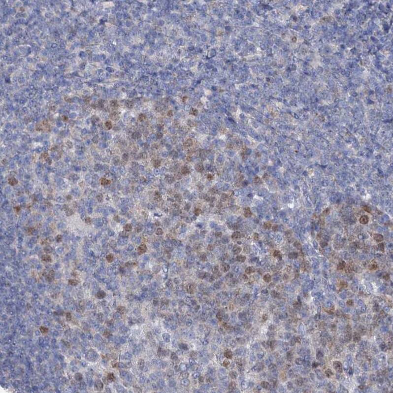 Staining of human tonsil shows weak to moderate nuclear positivity in germinal center cells.