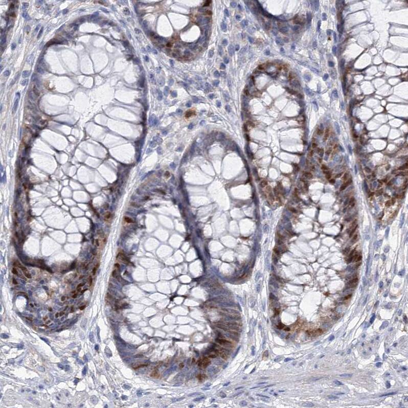 Staining of human rectum shows moderate nuclear positivity in glandular cells.