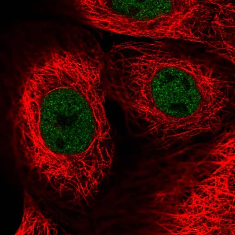 Staining of human cell line A-431 shows localization to nucleoplasm.