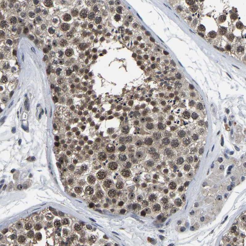 Staining of human testis shows moderate nuclear positivity in cells in seminiferous ducts.