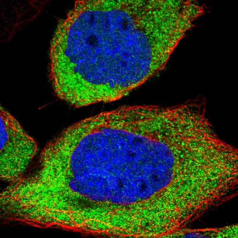Staining of human cell line A-431 shows localization to cytosol.