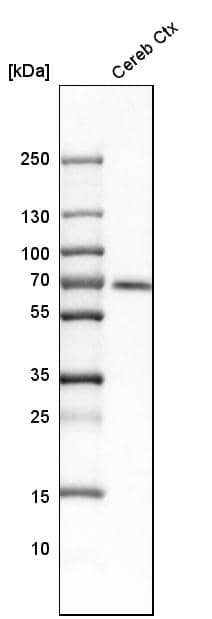 Analysis in human cerebral cortex tissue.