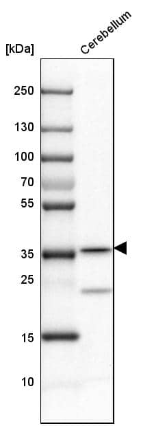 Analysis in mouse cerebellum tissue.