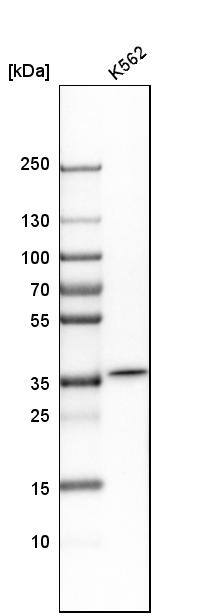 Analysis in human cell line K562.