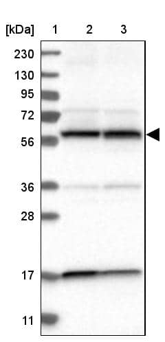 Lane 1: Marker [kDa] 230, 130, 95, 72, 56, 36, 28, 17, 11Lane 2: Human cell line RT-4Lane 3: Human cell line U-251MG sp