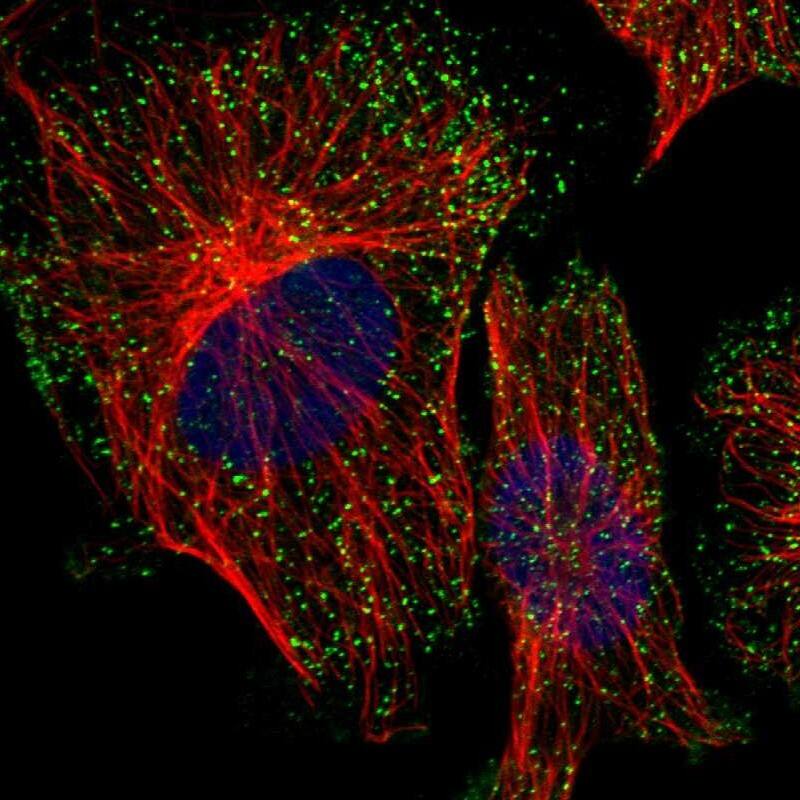 Staining of human cell line U-251 MG shows localization to vesicles.