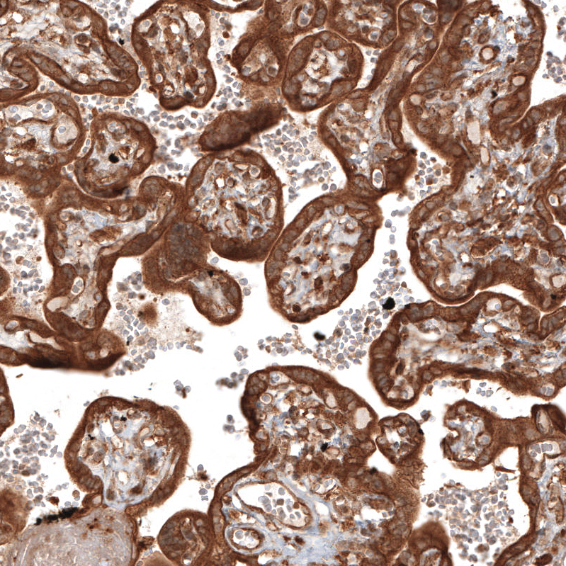 Immunohistochemistry-Paraffin TAX1BP1 Antibody - BSA Free