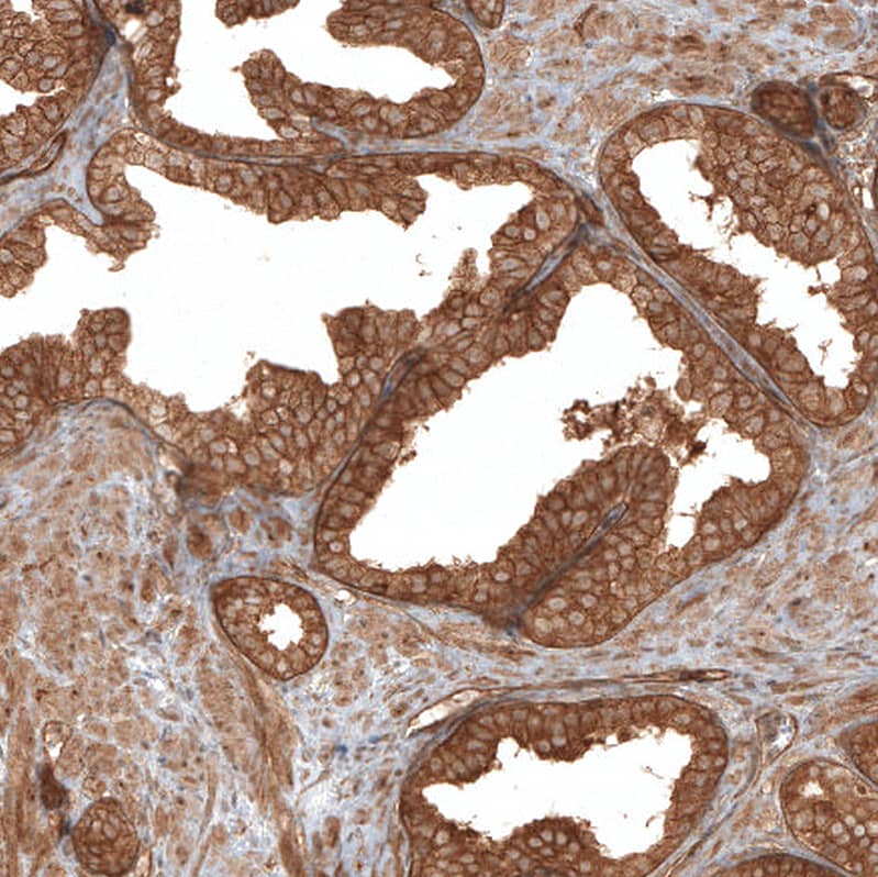Immunohistochemistry-Paraffin TAX1BP1 Antibody - BSA Free