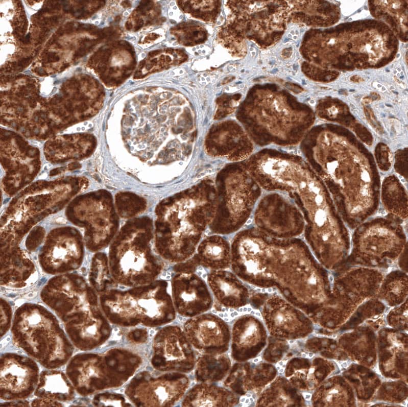 Immunohistochemistry-Paraffin CBARA1 Antibody - BSA Free