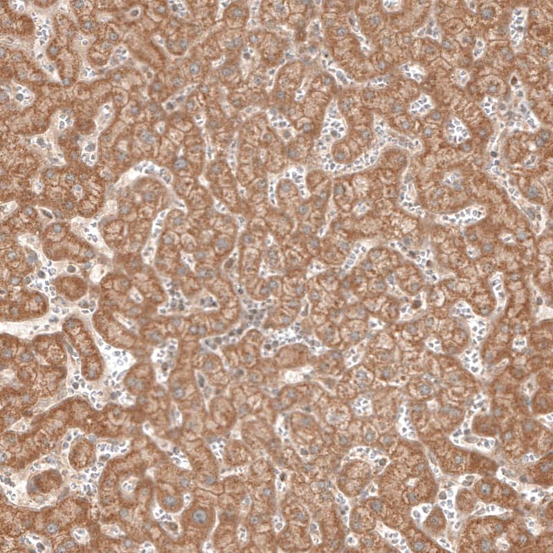 Immunohistochemistry-Paraffin CBARA1 Antibody - BSA Free