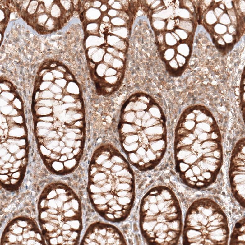 Staining of human rectum shows strong granular positivity in cytoplasm in glandular cells.