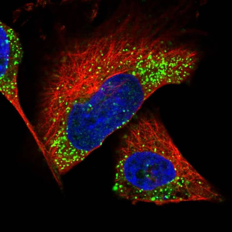 Immunocytochemistry/ Immunofluorescence Calbindin D-28K Antibody - BSA Free
