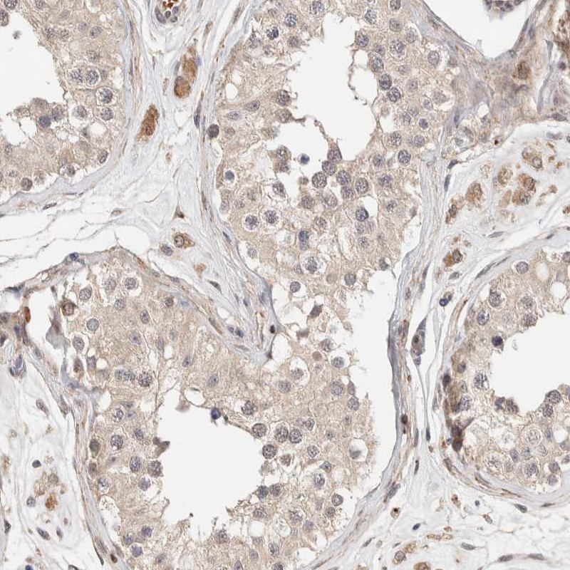 Staining of human testis shows low expression as expected.