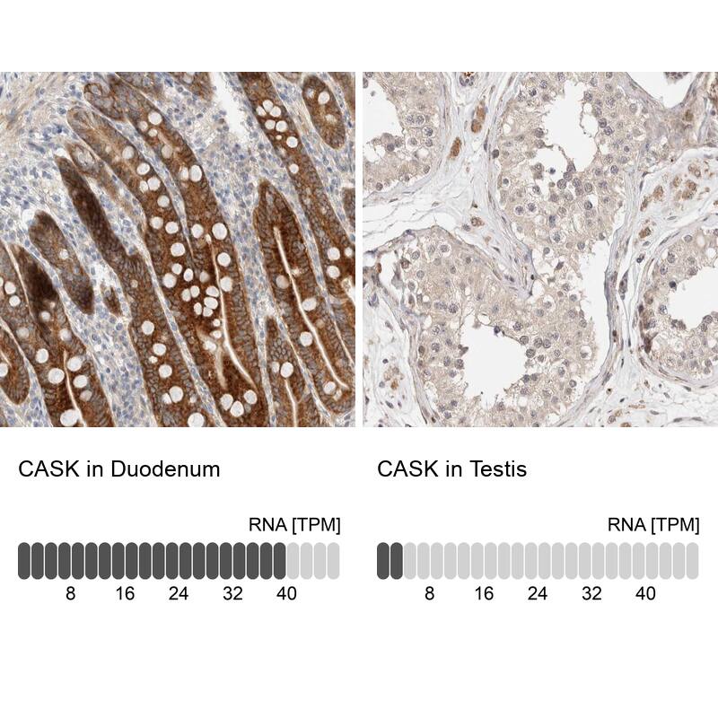 <b>Orthogonal Strategies Validation. </b>Analysis in human duodenum and testis tissues.