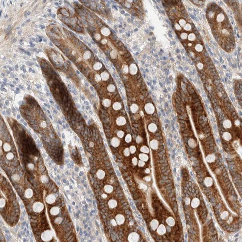 Staining of human duodenum shows high expression.