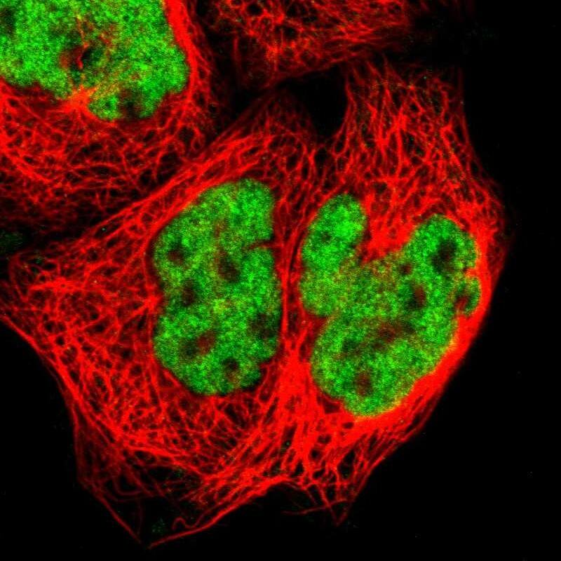 Staining of human cell line A-431 shows localization to nucleoplasm.