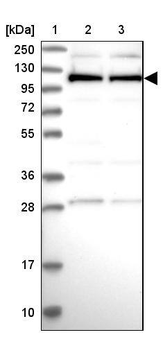 Lane 1: Marker [kDa] 250, 130, 95, 72, 55, 36, 28, 17, 10Lane 2: Human cell line RT-4Lane 3: Human cell line U-251MG sp
