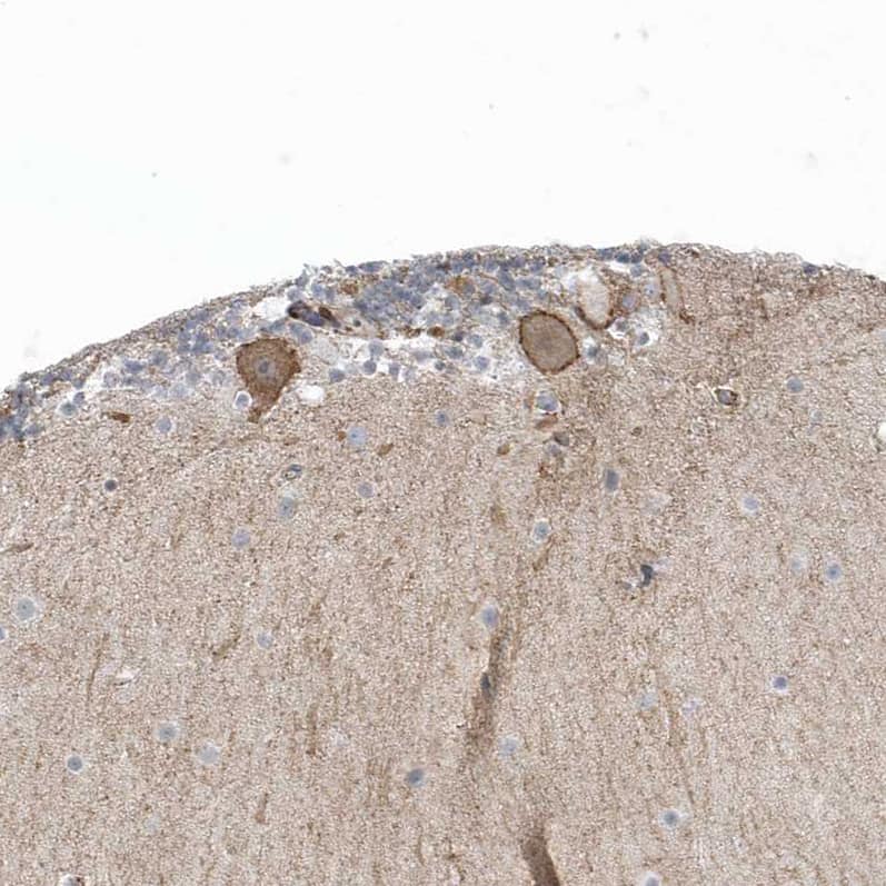 Staining of human cerebellum shows moderate to strong membranous positivity in Purkinje cells.