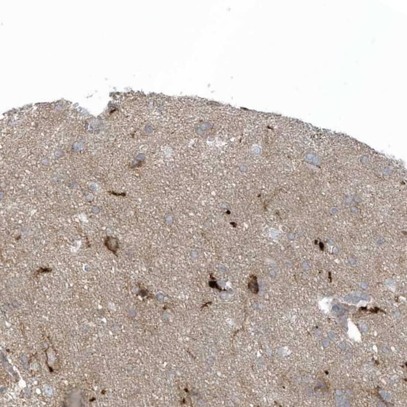 Staining of human cerebral cortex shows moderate to strong membranous positivity in neurons.