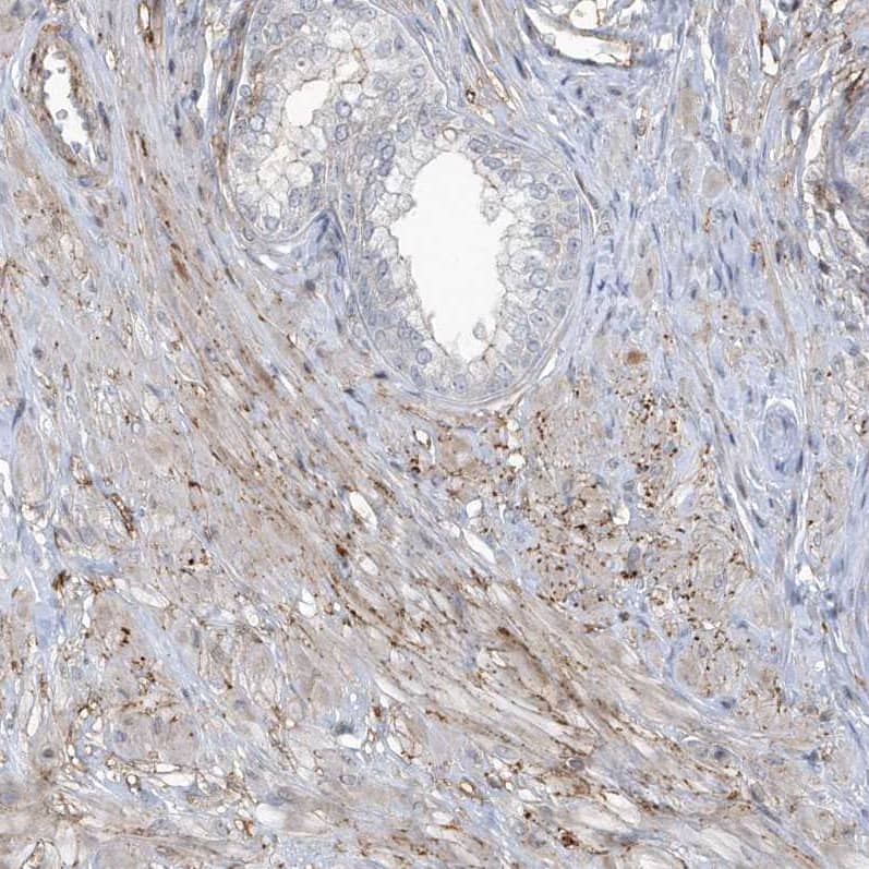 Staining of human prostate shows weak to moderate membranous positivity in smooth muscle cells.