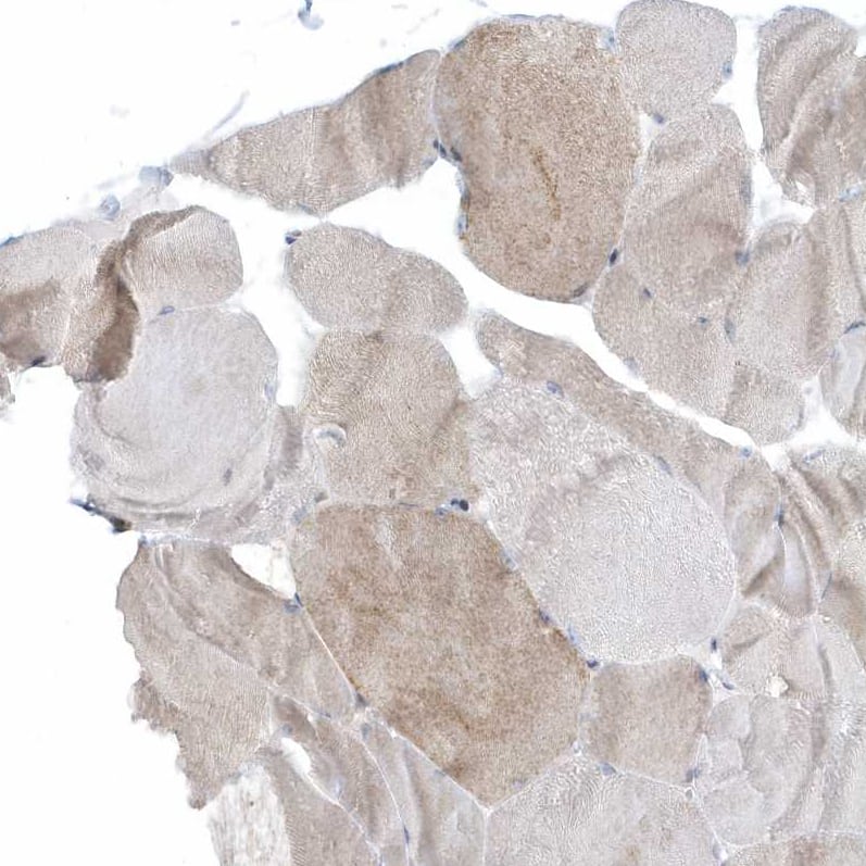 Staining of human skeletal muscle shows very weak positivity in myocytes.