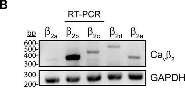 APEX2-mediated proximity biotinylation for the identification of proteins in the Cav beta 2b nanoenvironments in cardiomyocytes. (A) Schematic representation of the APEX2-mediated proximity biotinylation workflow. ARCs were transduced with the construct Cav beta 2b-V5-APEX2 using an adenoviral vector. APEX2 fused to Cav beta 2b enables the biotin labeling of proteins located within a 20-nm radius of Cav beta 2b when the substrates biotin-phenol and H2O2 are present. Biotinylated proteins are further enriched by streptavidin-coated beads through affinity purification and bound proteins are analyzed by mass spectrometry. (B) RT-PCR analysis of the expression pattern of the five Cav beta 2 splice variants (Cav beta 2a-Cav beta 2e) in ARCs. GAPDH was used as control. (C) Western blot analyses to validate the specificity of the anti-Cav beta 2b antibody using lysates from HEK-293 cells overexpressing the different Cav beta 2 splice variants. A commercial anti-Cav beta 2 and an anti-GAPDH antibodies were used as expression and loading controls, respectively. (D) Western blot analysis of Cav beta 2b-V5-APEX2 expression in ARCs (i) and confocal fluorescence images of ARCs expressing or not Cav beta 2b-V5-APEX2 and visualized using anti-Cav beta 2b and anti-V5 antibodies to recognize the endogenous and the recombinant Cav beta 2b proteins, respectively (ii). Scale bar represents 15 μm. (E) Streptavidin blot analysis of endogenous proteins biotinylated by Cav beta 2b-V5-APEX2 in ARCs. (F) Biotinylation of Cav1.2 by Cav beta 2b-V5-APEX2. Western blot analysis using an anti-Cav1.2 antibody after streptavidin-mediated enrichment of biotinylated proteins. All the data shown are representative of three independent experiments. APEX2, ascorbate peroxidase; ARCs, adult rat cardiomyocytes; RyR2, ryanodine receptor 2; bp, base pairs. Image collected and cropped by CiteAb from the following open publication (//pubmed.ncbi.nlm.nih.gov/35047492), licensed under a CC-BY license. Not internally tested by Novus Biologicals.