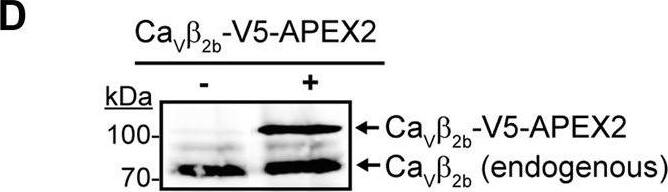 APEX2-mediated proximity biotinylation for the identification of proteins in the Cav beta 2b nanoenvironments in cardiomyocytes. (A) Schematic representation of the APEX2-mediated proximity biotinylation workflow. ARCs were transduced with the construct Cav beta 2b-V5-APEX2 using an adenoviral vector. APEX2 fused to Cav beta 2b enables the biotin labeling of proteins located within a 20-nm radius of Cav beta 2b when the substrates biotin-phenol and H2O2 are present. Biotinylated proteins are further enriched by streptavidin-coated beads through affinity purification and bound proteins are analyzed by mass spectrometry. (B) RT-PCR analysis of the expression pattern of the five Cav beta 2 splice variants (Cav beta 2a-Cav beta 2e) in ARCs. GAPDH was used as control. (C) Western blot analyses to validate the specificity of the anti-Cav beta 2b antibody using lysates from HEK-293 cells overexpressing the different Cav beta 2 splice variants. A commercial anti-Cav beta 2 and an anti-GAPDH antibodies were used as expression and loading controls, respectively. (D) Western blot analysis of Cav beta 2b-V5-APEX2 expression in ARCs (i) and confocal fluorescence images of ARCs expressing or not Cav beta 2b-V5-APEX2 and visualized using anti-Cav beta 2b and anti-V5 antibodies to recognize the endogenous and the recombinant Cav beta 2b proteins, respectively (ii). Scale bar represents 15 μm. (E) Streptavidin blot analysis of endogenous proteins biotinylated by Cav beta 2b-V5-APEX2 in ARCs. (F) Biotinylation of Cav1.2 by Cav beta 2b-V5-APEX2. Western blot analysis using an anti-Cav1.2 antibody after streptavidin-mediated enrichment of biotinylated proteins. All the data shown are representative of three independent experiments. APEX2, ascorbate peroxidase; ARCs, adult rat cardiomyocytes; RyR2, ryanodine receptor 2; bp, base pairs. Image collected and cropped by CiteAb from the following open publication (//pubmed.ncbi.nlm.nih.gov/35047492), licensed under a CC-BY license. Not internally tested by Novus Biologicals.