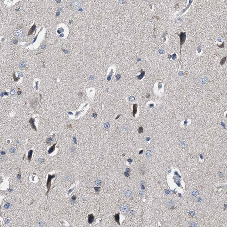 Staining of human testis shows strong cytoplasmic positivity in Leydig cells.