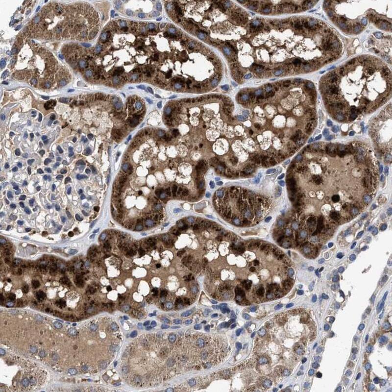 Staining of human kidney shows strong cytoplasmic positivity in cells in tubules.