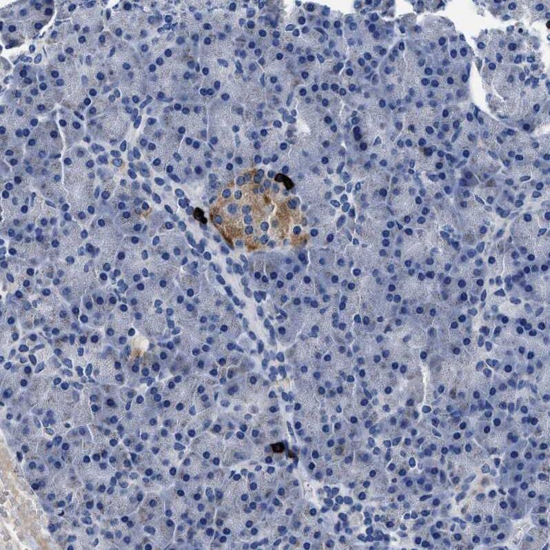 Staining of human skin shows no cytoplasmic positivity in squamous epithelial cells as expected.