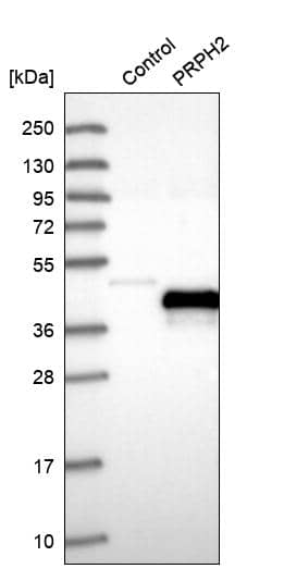 Analysis in control (vector only transfected HEK293T lysate) and PRPH2 over-expression lysate (Co-expressed with a C-terminal myc-DDK tag (~3.1 kDa) in mammalian HEK293T cells).