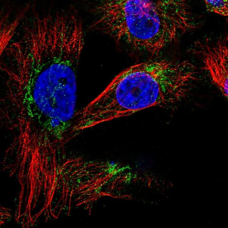 Staining of human cell line U-251 MG shows positivity in cytoplasm & mitochondria.