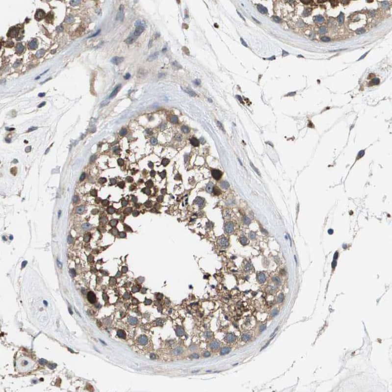 Immunohistochemistry-Paraffin SLC25A20 Antibody - BSA Free