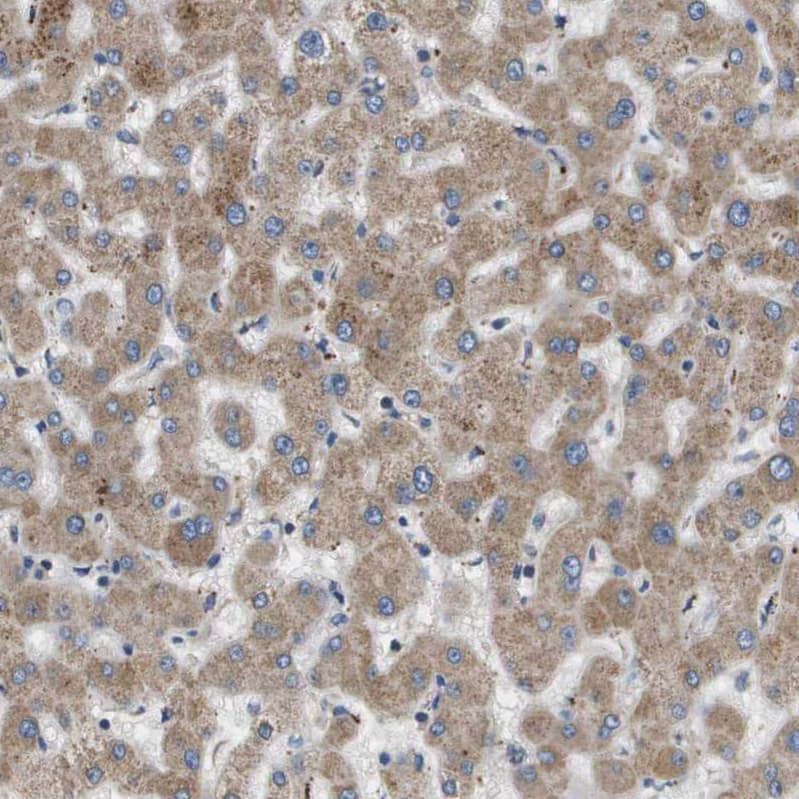 Staining of human liver shows moderate cytoplasmic positivity in hepatocytes.