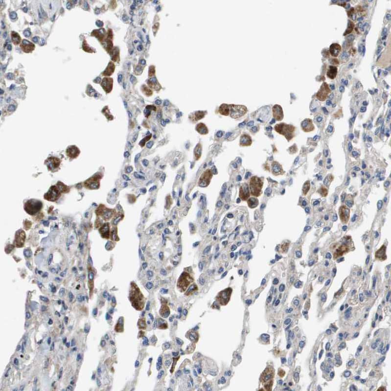 Staining of human lung shows moderate cytoplasmic positivity in macrophages.