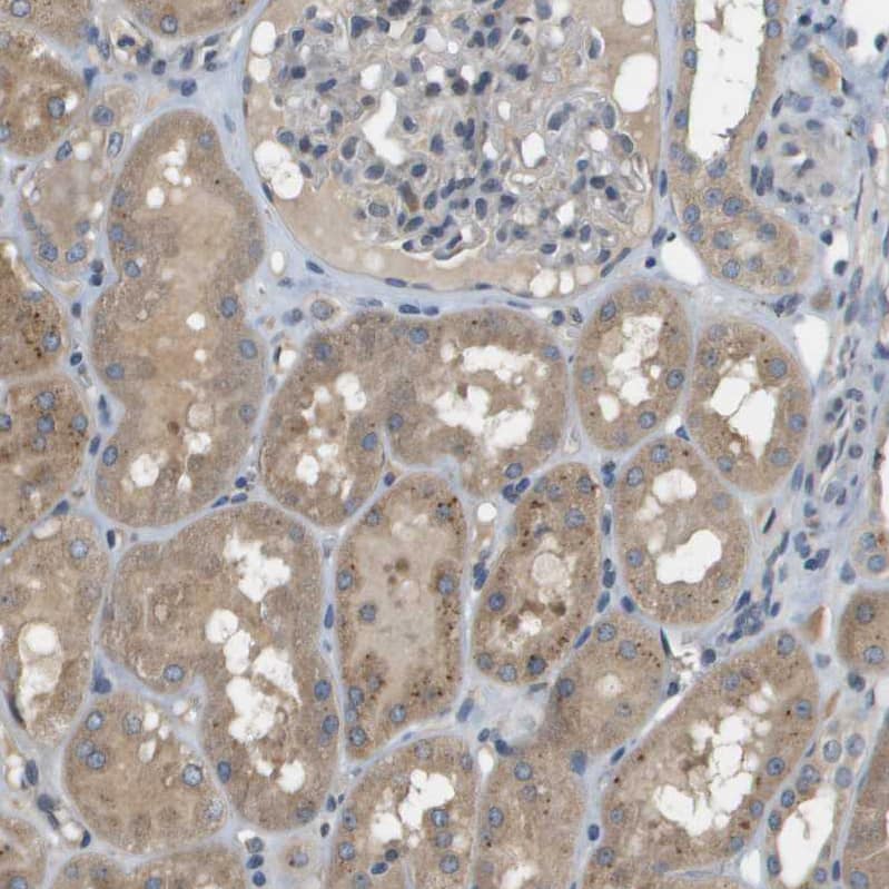 Staining of human kidney shows moderate cytoplasmic positivity in cells in tubules.
