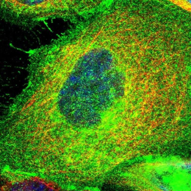 Immunohistochemistry-Paraffin PGAP3 Antibody - BSA Free