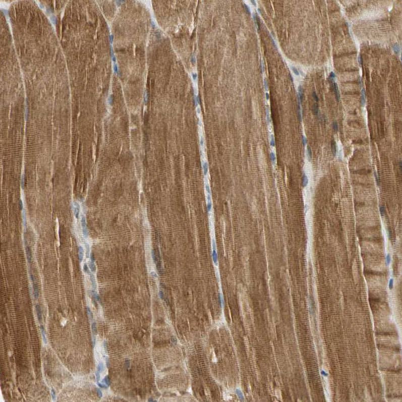 Staining of human skeletal muscle shows strong cytoplasmic positivity in myocytes.