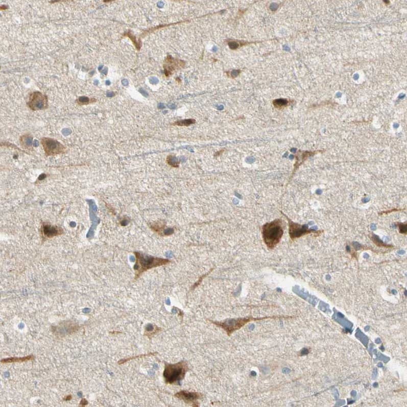 Staining of human cerebral cortex shows strong cytoplasmic positivity in neurons.