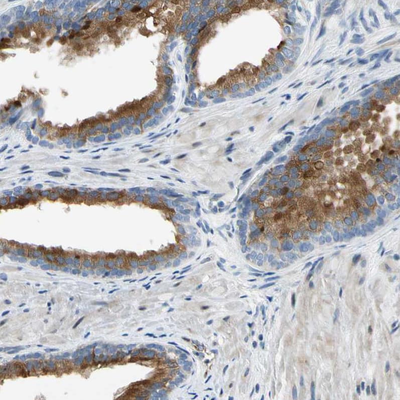 Staining of human prostate shows moderate cytoplasmic positivity in glandular cells.