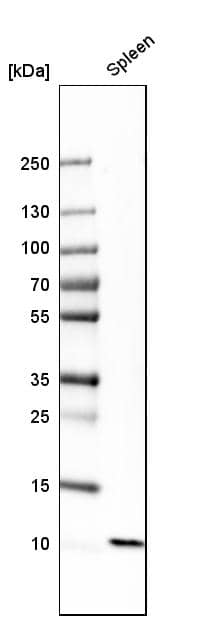 Analysis in human spleen tissue.