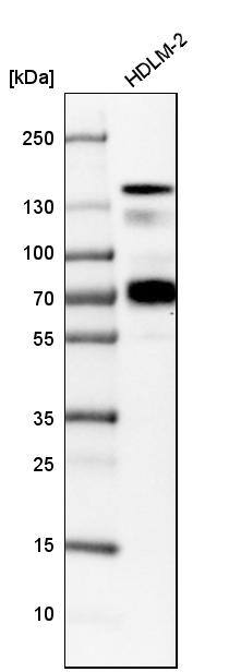 Analysis in human cell line HDLM-2.
